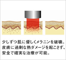 サンプル画像